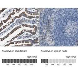 ACADVL Antibody, Novus Biologicals 0.1mL; Unlabeled:Antibodies, Polyclonal