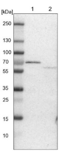 ACADVL Antibody, Novus Biologicals 0.1mL; Unlabeled:Antibodies, Polyclonal