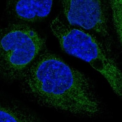 ACAT Antibody, Novus Biologicals 0.1mL; Unlabeled:Antibodies, Polyclonal