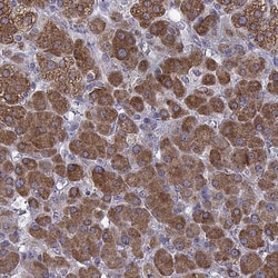 ACAT Antibody, Novus Biologicals 0.1mL; Unlabeled:Antibodies, Polyclonal