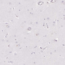 ACAT Antibody, Novus Biologicals 0.1mL; Unlabeled:Antibodies, Polyclonal