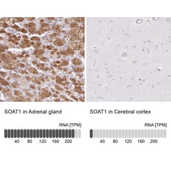 ACAT Antibody, Novus Biologicals 0.1mL; Unlabeled:Antibodies, Polyclonal