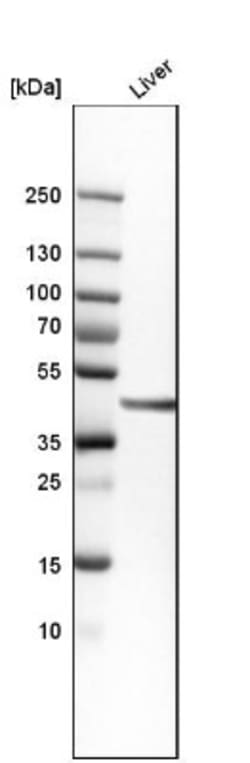 ACAT1 Antibody, Novus Biologicals:Antibodies:Primary Antibodies