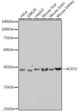 ACAT2 Rabbit anti-Human, Mouse, Rat, Clone: 6Z5L1, Novus Biologicals 20 &mu;g | Buy Online | Bio-Techne | Fisher Scientific