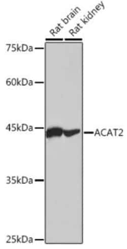 ACAT2 Rabbit anti-Human, Mouse, Rat, Clone: 6Z5L1, Novus Biologicals 20 &mu;g | Buy Online | Bio-Techne | Fisher Scientific