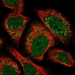 ACBD4 Antibody, Novus Biologicals:Antibodies:Primary Antibodies