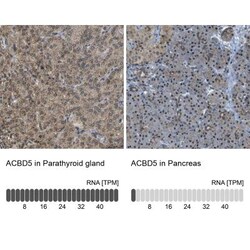 ACBD5 Antibody, Novus Biologicals 0.1mL; Unlabeled:Antibodies, Polyclonal