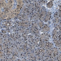 ACBD5 Antibody, Novus Biologicals 0.1mL; Unlabeled:Antibodies, Polyclonal