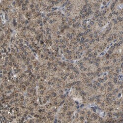 ACBD5 Antibody, Novus Biologicals 0.1mL; Unlabeled:Antibodies, Polyclonal