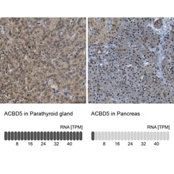 ACBD5 Antibody, Novus Biologicals 0.1mL; Unlabeled:Antibodies, Polyclonal