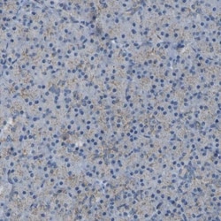 ACBD5 Antibody, Novus Biologicals:Antibodies:Primary Antibodies
