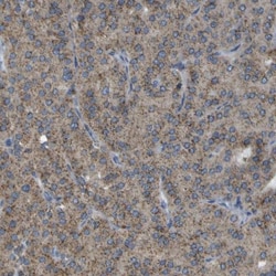ACBD5 Antibody, Novus Biologicals:Antibodies:Primary Antibodies