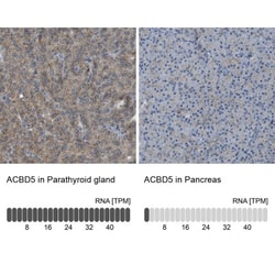 ACBD5 Antibody, Novus Biologicals:Antibodies:Primary Antibodies