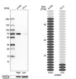 ACBD5 Antibody, Novus Biologicals 0.1mL; Unlabeled:Antibodies, Polyclonal