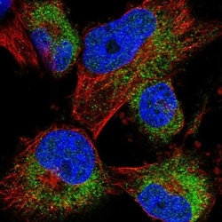ACBD7 Antibody, Novus Biologicals:Antibodies:Primary Antibodies