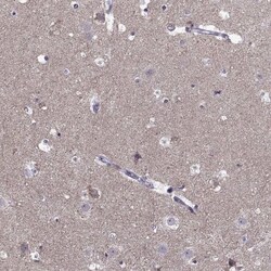 ACCN1 Antibody, Novus Biologicals 25 &mu;L, Unlabeled:Antibodies, Polyclonal