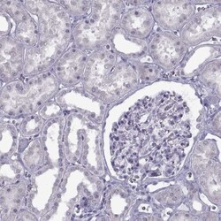 ACCN1 Antibody, Novus Biologicals 25 &mu;L, Unlabeled:Antibodies, Polyclonal