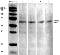 ACCN2 Antibody (S271-44), Novus Biologicals 0.025 mg, Unconjugated:Antibodies,