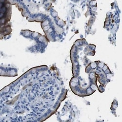 ACCN5 Antibody, Novus Biologicals:Antibodies:Primary Antibodies
