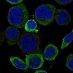 ACCSL Rabbit anti-Human, Polyclonal, Novus Biologicals 100 &mu;g; Unconjugated:Antibodies,