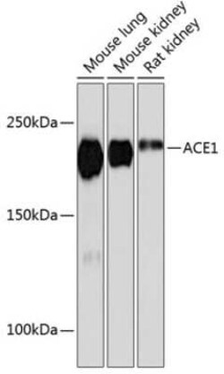 ACE/CD143 Rabbit anti-Mouse, Rat, Clone: 1C9J3, Novus Biologicals 100 &mu;g;