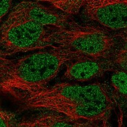 ACF Antibody, Novus Biologicals 0.1mL; Unlabeled:Antibodies, Polyclonal