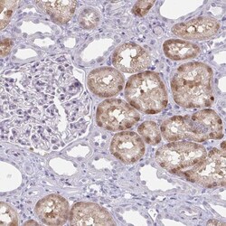 ACF Antibody, Novus Biologicals 0.1mL; Unlabeled:Antibodies, Polyclonal