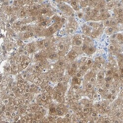 ACMSD Antibody, Novus Biologicals 0.1mL; Unlabeled:Antibodies, Polyclonal