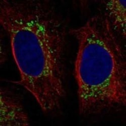 ACN9 Rabbit anti-Human, Polyclonal, Novus Biologicals 25 &mu;g | Buy Online | Novus Biologicals | Fisher Scientific