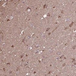 ACOT6 Antibody, Novus Biologicals 0.1mL; Unlabeled:Antibodies, Polyclonal