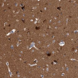 ACOT7 Antibody, Novus Biologicals 0.1mL; Unlabeled:Antibodies, Polyclonal