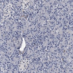 ACOT7 Antibody, Novus Biologicals 0.1mL; Unlabeled:Antibodies, Polyclonal