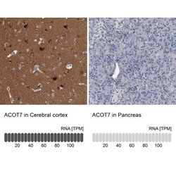 ACOT7 Antibody, Novus Biologicals 0.1mL; Unlabeled:Antibodies, Polyclonal