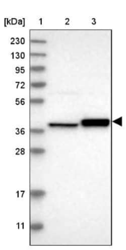 ACOT7 Antibody, Novus Biologicals 0.1mL; Unlabeled:Antibodies, Polyclonal