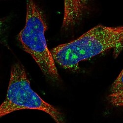 ACOX1 Antibody, Novus Biologicals 0.1mL; Unlabeled:Antibodies, Polyclonal