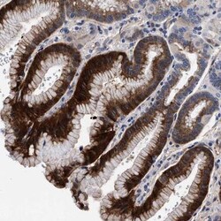 ACOX1 Antibody, Novus Biologicals 0.1mL; Unlabeled:Antibodies, Polyclonal