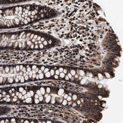 ACOX1 Antibody, Novus Biologicals 25 &mu;L; Unlabeled:Antibodies, Polyclonal