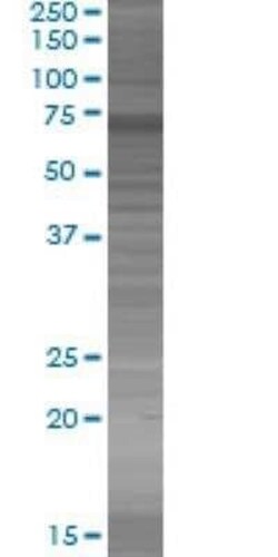 Novus Biologicals ACOX1 293T Cell Transient Overexpression Lysate 0.1 mL | Buy Online | Novus Biologicals&trade; | Fisher Scientific