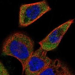 ACOXL Antibody, Novus Biologicals 25 &mu;L, Unlabeled:Antibodies, Polyclonal