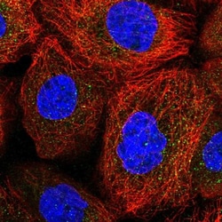ACOXL Antibody, Novus Biologicals:Antibodies:Primary Antibodies