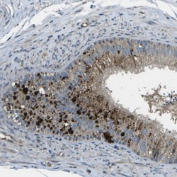 ACPL2 Antibody, Novus Biologicals:Antibodies:Primary Antibodies