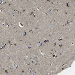ACPL2 Antibody, Novus Biologicals:Antibodies:Primary Antibodies