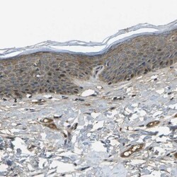 ACPL2 Antibody, Novus Biologicals:Antibodies:Primary Antibodies