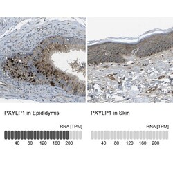 ACPL2 Antibody, Novus Biologicals:Antibodies:Primary Antibodies