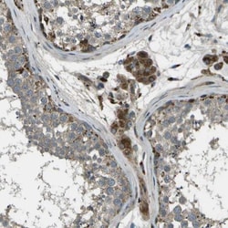 ACPL2 Antibody, Novus Biologicals:Antibodies:Primary Antibodies