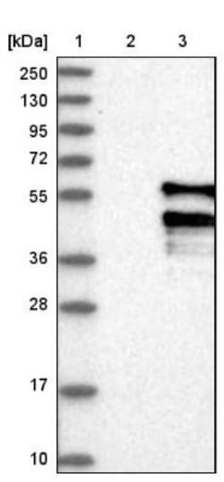 ACPL2 Antibody, Novus Biologicals:Antibodies:Primary Antibodies