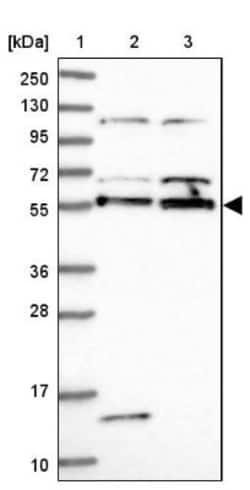 ACRBP Antibody, Novus Biologicals 0.1 mL | Buy Online | Novus Biologicals | Fisher Scientific