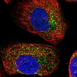 ACRC Antibody, Novus Biologicals:Antibodies:Primary Antibodies