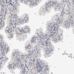 ACRC Antibody, Novus Biologicals:Antibodies:Primary Antibodies
