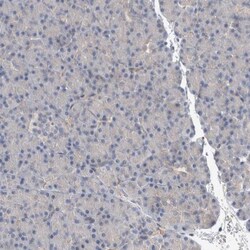 ACRC Antibody, Novus Biologicals:Antibodies:Primary Antibodies